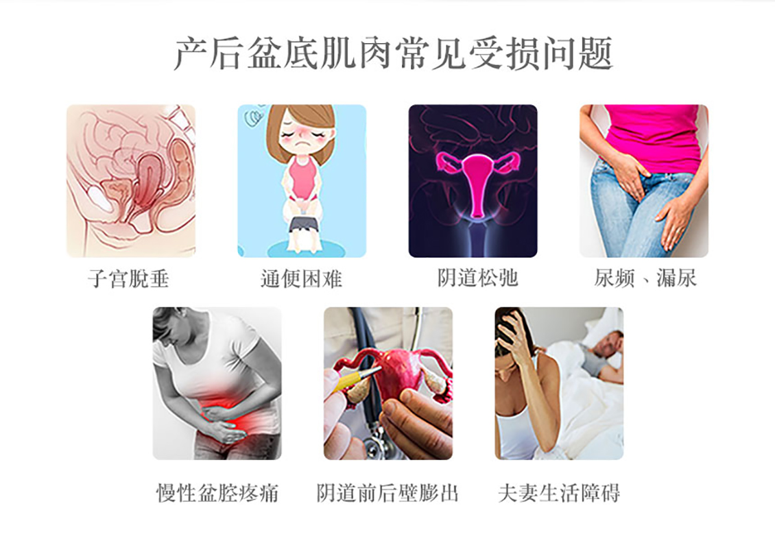 盆底肌肉康复器