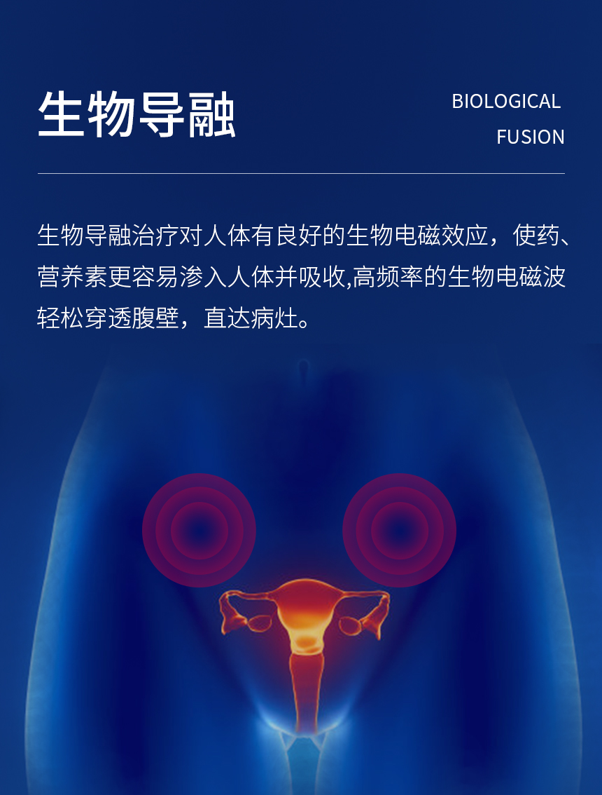 玛莎莉妇科生物导融系统