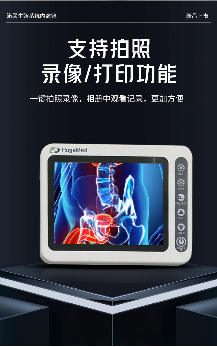 泌尿生殖内窥镜检查系统